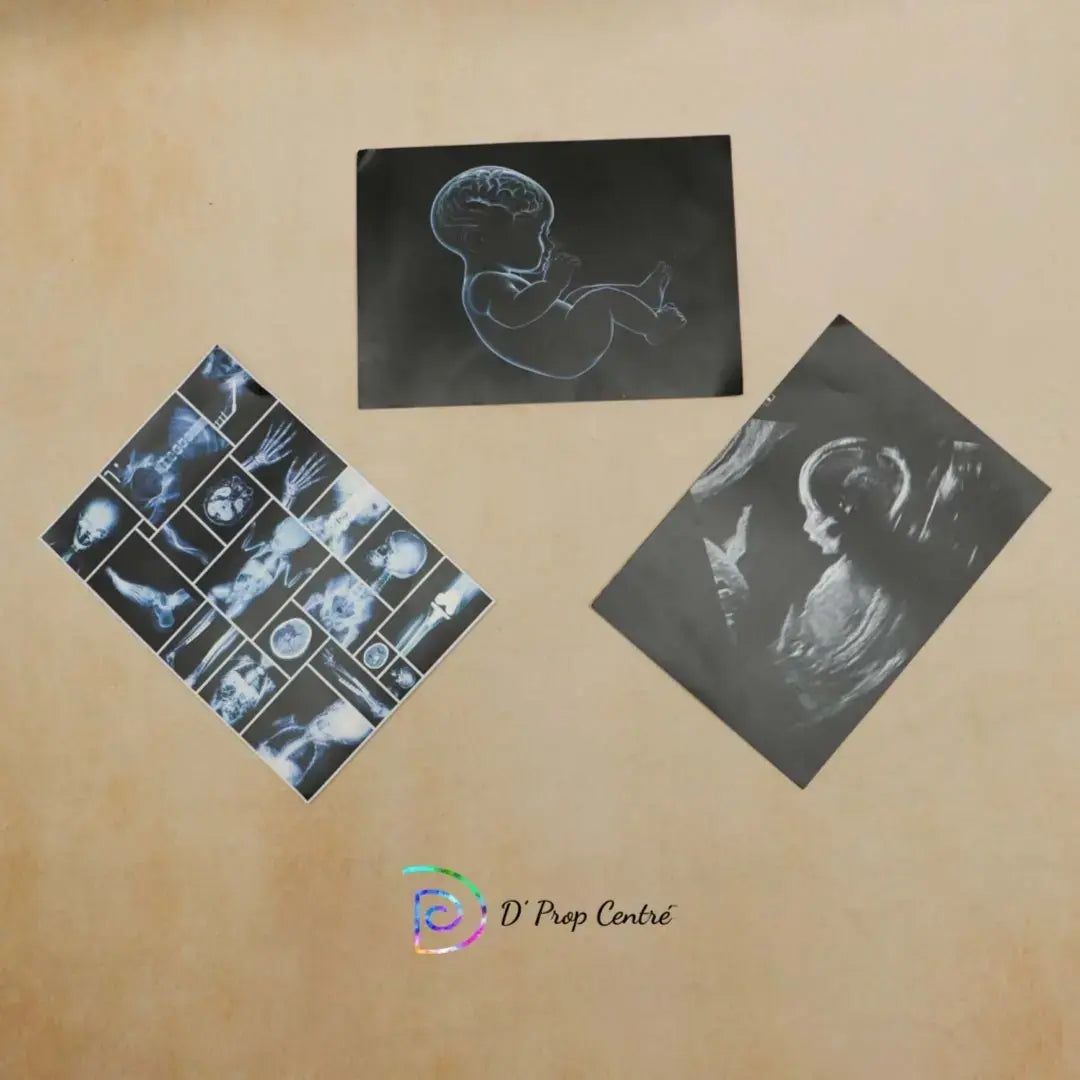 X-Ray Set of 3